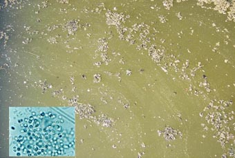 Aspecto de agua analizada en el lago de la Albufera y fotografía al microscopio de la microalga tóxica Microcystis.